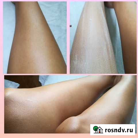 Шугаринг Омск - изображение 1