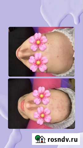 Косметолог эстетист Ставрополь - изображение 1