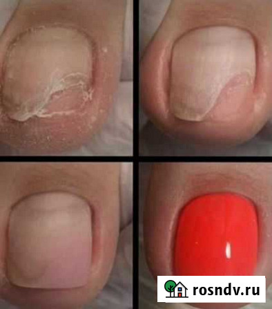 Медицинский педикюр /Маникюр/Гель-Лак Черкесск - изображение 1