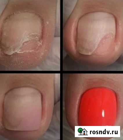 Медицинский педикюр /Маникюр/Гель-Лак Черкесск - изображение 1