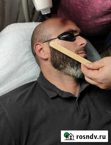 Лазерная эпиляция для мужчин Махачкала - изображение 1