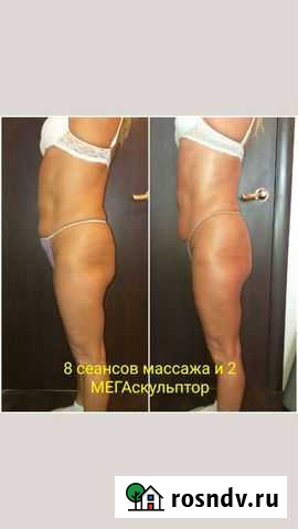 Антицеллюлитный массаж,лифтинг, коррекция фигуры Рязань - изображение 1