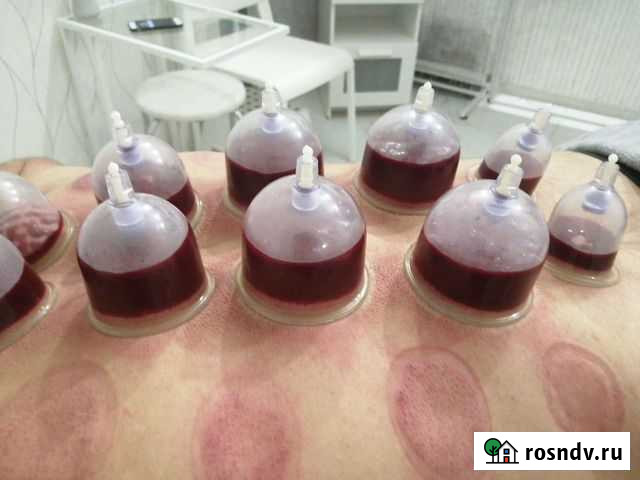 Масаж-хиддама Казань - изображение 1