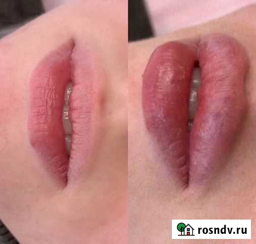 Косметолог Ростов-на-Дону - изображение 1