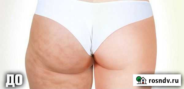 Моделирующий массаж Саранск - изображение 1