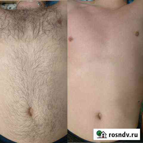 Мужская и женская депиляция. Сахар,воск,фитосмола Нижневартовск