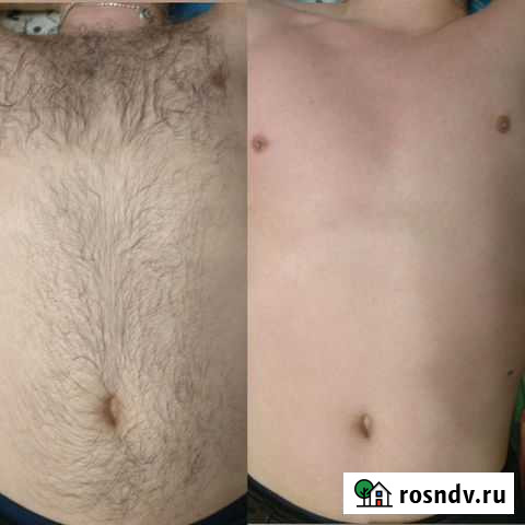 Мужская и женская депиляция. Сахар,воск,фитосмола Нижневартовск - изображение 1