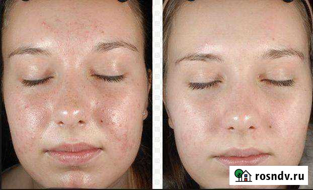 Крема Новосибирск - изображение 1