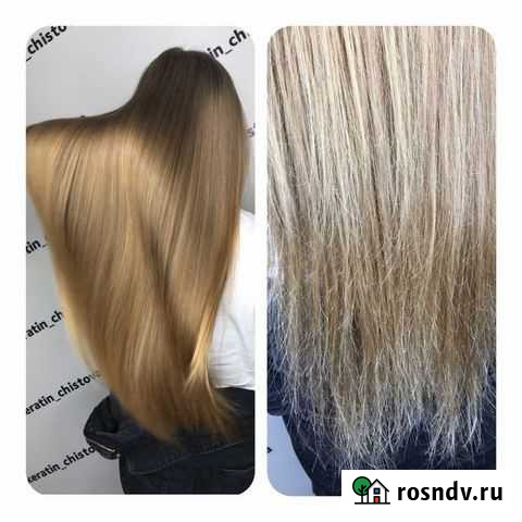 Ботокс Казань - изображение 1