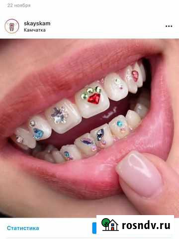 Косметология скайс Петропавловск-Камчатский - изображение 1