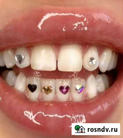Скайсы Липецк - изображение 1