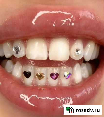 Скайсы Липецк - изображение 1