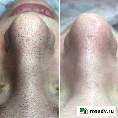 Косметология Симферополь - изображение 1