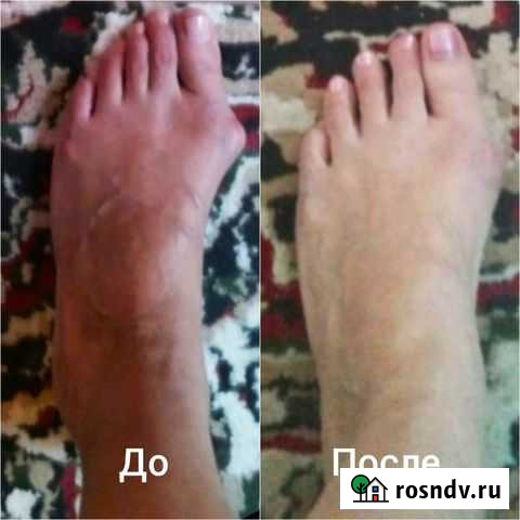 Оздоровительная коррекция тела. Массаж Калининград - изображение 1