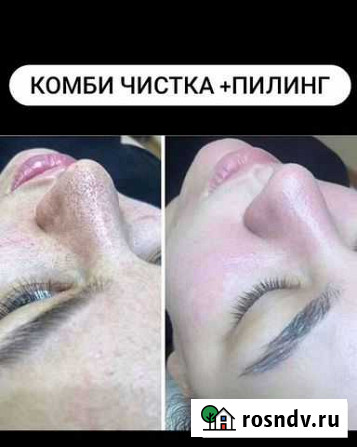 Комбинированная чистка лица.Пилинг.Массаж лица Барнаул - изображение 1