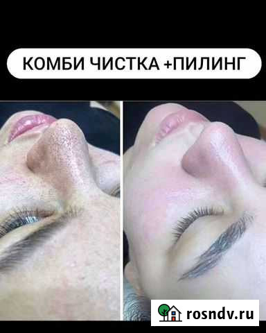 Комбинированная чистка лица.Пилинг.Массаж лица Барнаул - изображение 1