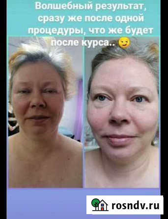 Французский скульптурный массаж лица Ковров - изображение 1
