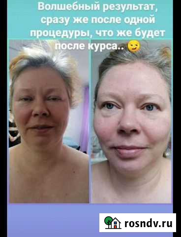 Французский скульптурный массаж лица Ковров - изображение 1