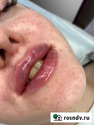 Шугаринг,пирсинг,любые виды косметологических услу Казань - изображение 1