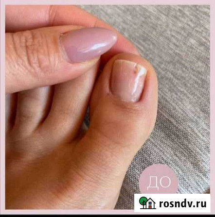 Подология педикюр Барнаул - изображение 1