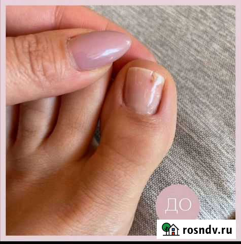 Подология педикюр Барнаул - изображение 1