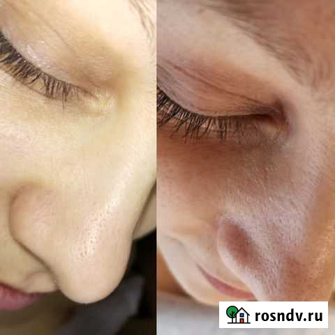 Услуги косметолога Екатеринбург - изображение 1