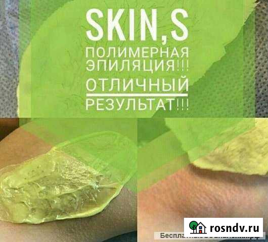 Полимерная депиляция skinS Минусинск - изображение 1