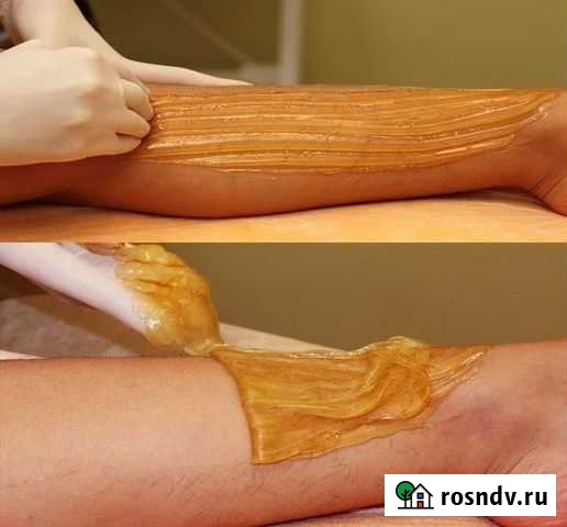 Шугаринг Волгоград - изображение 1