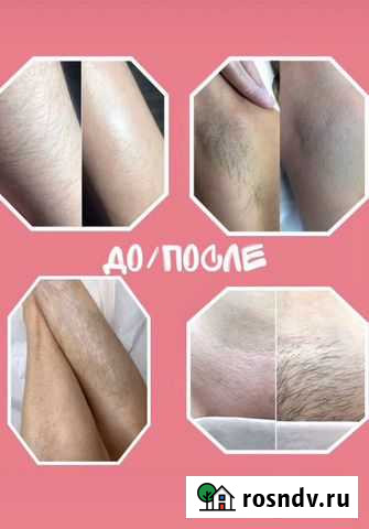 Шугаринг, Эпиляция воском (Мещера) Нижний Новгород - изображение 1