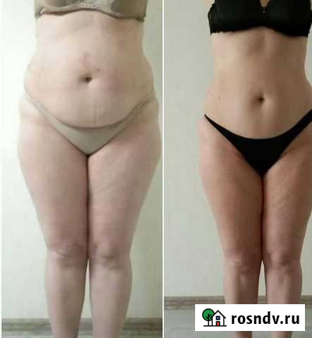 Массаж Волгоград - изображение 1