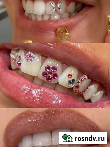 Скайсы Тверь - изображение 1