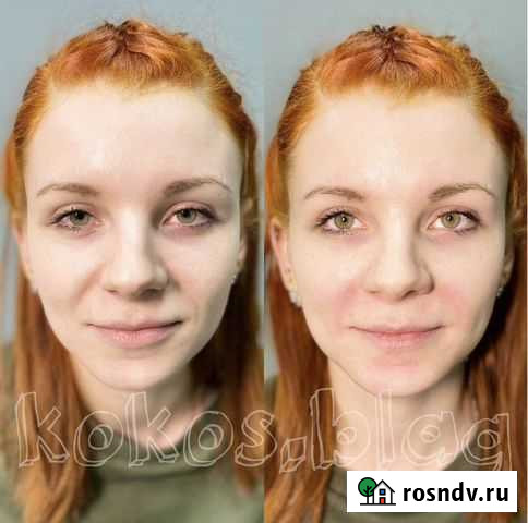 Нужны модели(услуги косметолога) Благовещенск - изображение 1