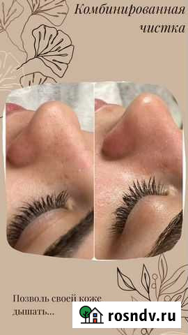 Услуги косметолога Воронеж - изображение 1