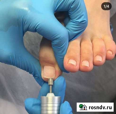Педикюр аппаратный с элементами подологии Городище - изображение 1