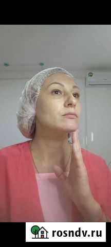 Чистка лица пилинги Краснодар - изображение 1