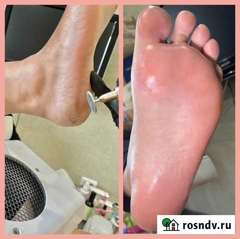 Смарт педикюр Ноябрьск - изображение 1