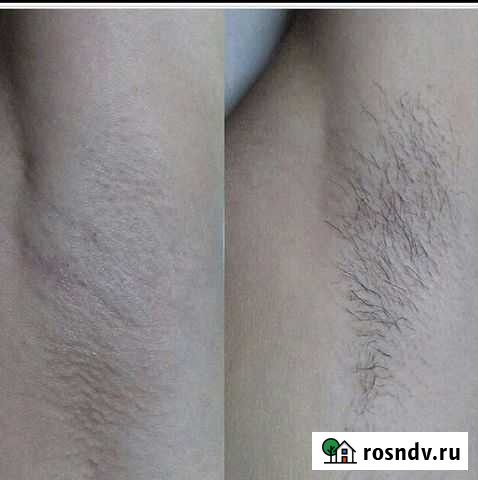 Шугаринг Лянтор - изображение 1