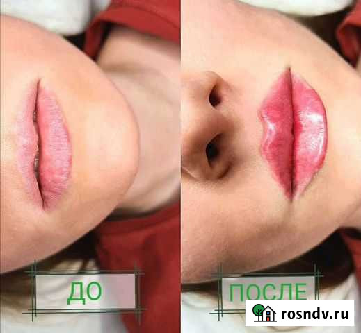 Косметолог Омск - изображение 1