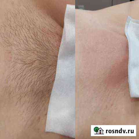 Шугаринг/воск женский и мужской Волгоград