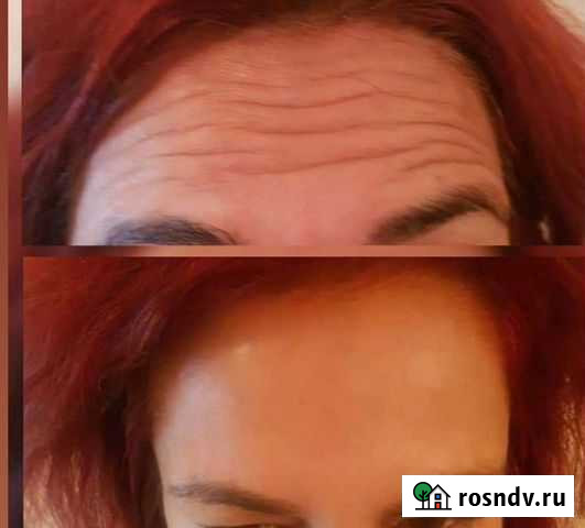 Косметолог Новосибирск - изображение 1