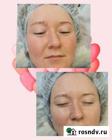 Косметология Киров - изображение 1