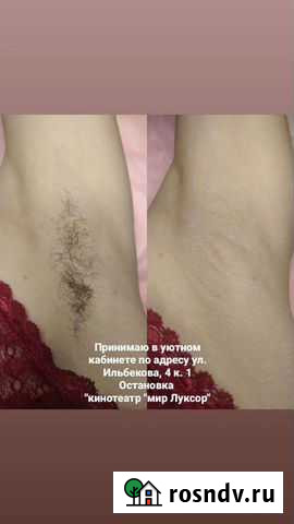 Сахарная эпиляция (шугаринг) Чебоксары - изображение 1