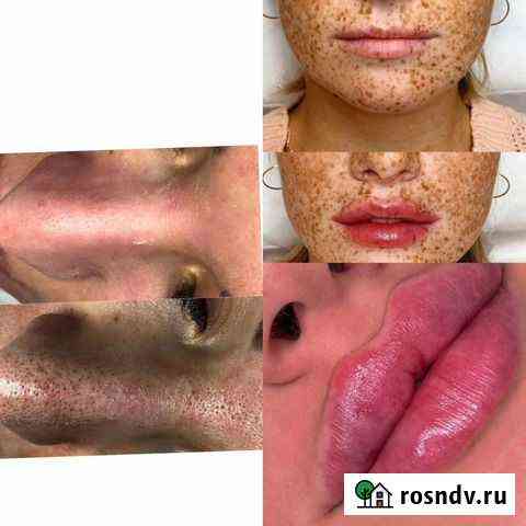 Услуги косметолога Грозный