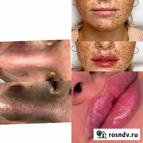 Услуги косметолога Грозный - изображение 1