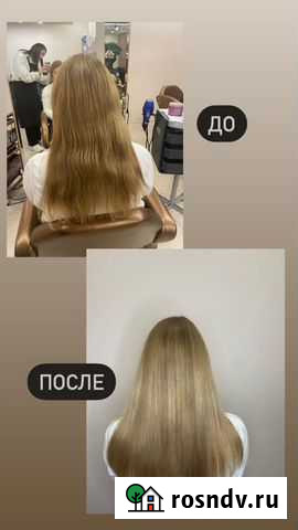 Холодный ботокс Череповец - изображение 1