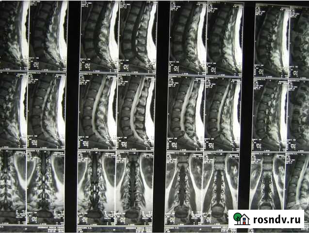 Лечебный массаж. Выезд на дом Ульяновск - изображение 1