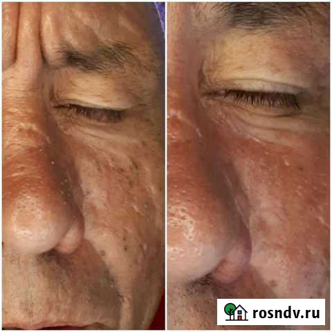 Косметолог- эстетист Чебоксары - изображение 1