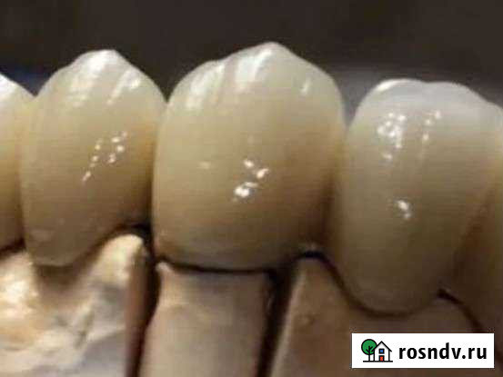 Зубной техник Ставрополь - изображение 1