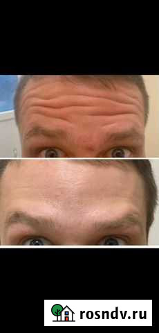 Мужская косметология Махачкала - изображение 1