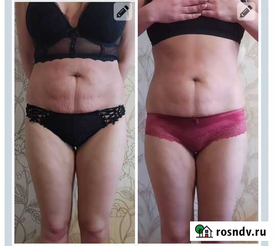 Массаж Самара - изображение 1